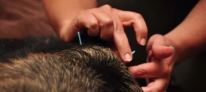 What is pet acupuncture for comfort